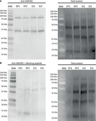 Aldose Reductase B1 in Pig Sperm Is Related to Their Function and Fertilizing Ability